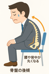 骨盤後傾丸くなる